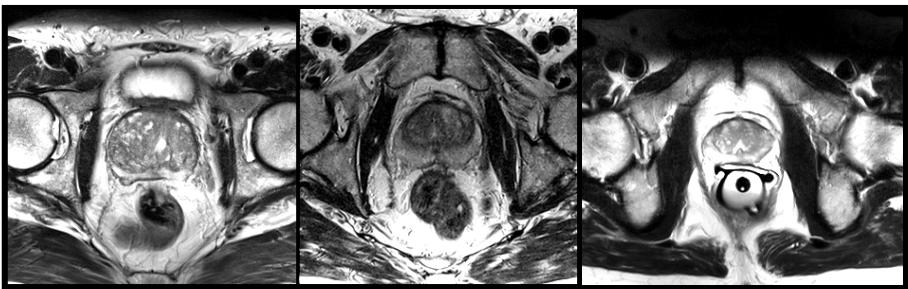 Slices from MRI volumes depicting the prostate, which is the target for segmentation in this study.