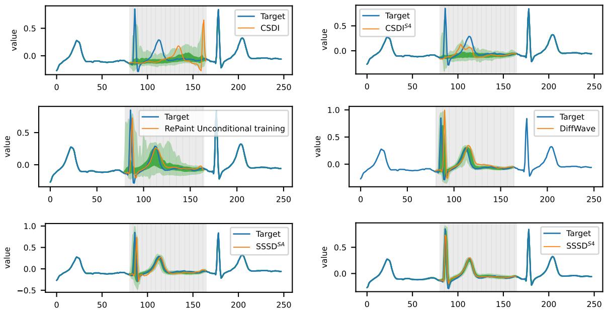 Visual comparison of blackout imputations on an ECG signal. CSDI (top-left) fails to produce a meaningful signal, while SSSD-S4 (bottom-right) generates a realistic and accurate ECG waveform.