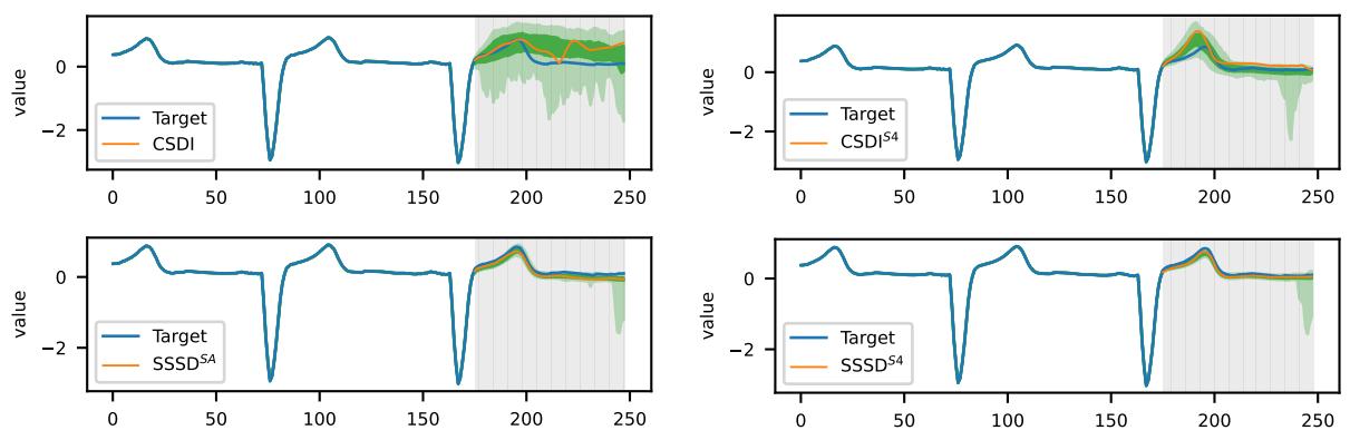 Visual comparison of forecasting on an ECG signal. SSSD-based models produce more accurate and confident predictions.