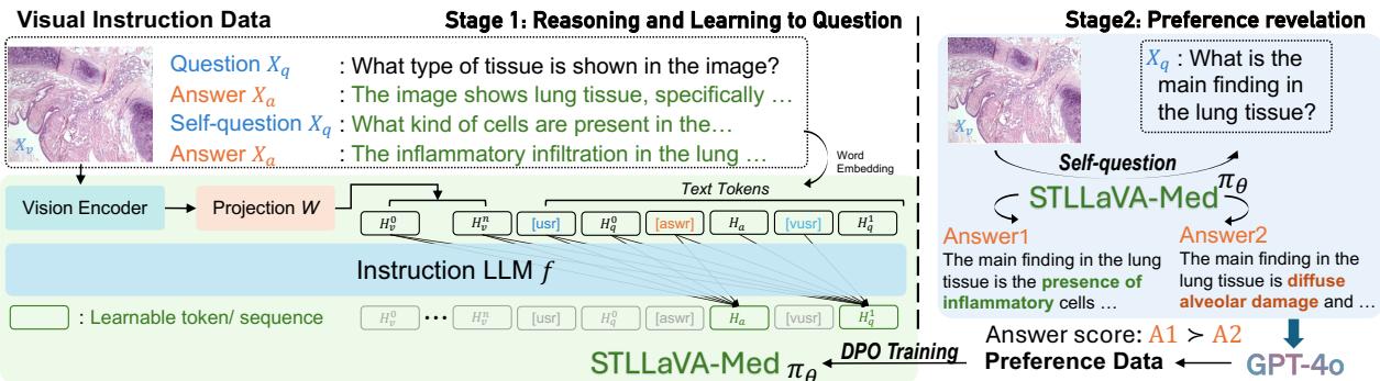 Figure 2: Model architecture of STLLaVA-Med and self-training pipeline. Left: stage 1 aiming to optimize the model improving medical image reasoning and learning to question. Right: in stage 2, we first prompt to auto-generate preference data under the guidance of GPT-4o, then supervise for DPO fine-tuning.