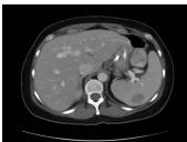 Figure 3: Prompt for GPT-4o to grade the answers generated by STLLaVA-Med from stage 1. The answer with the higher score will be designated as the winning response, while the other will be classified as rejected.