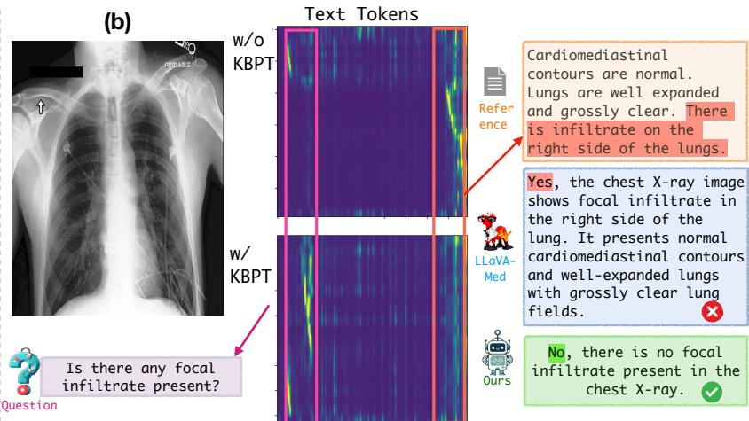 Figure 3: Attention maps comparing the model without KBPT vs. with KBPT.