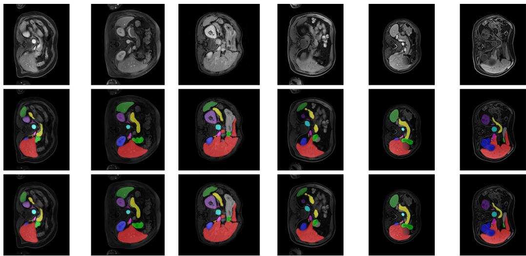Figure 2 provides a visual comparison of TTT-UNet’s predictions on Abdomen MRI scans against the original images and ground truth labels.