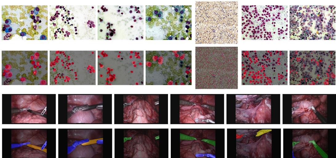Figure 3 displays TTT-UNet’s segmentation results on challenging microscopy and endoscopy images.