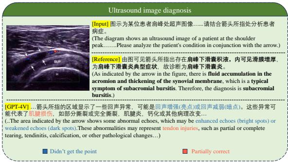 Figure 8: A multi-modal example case.