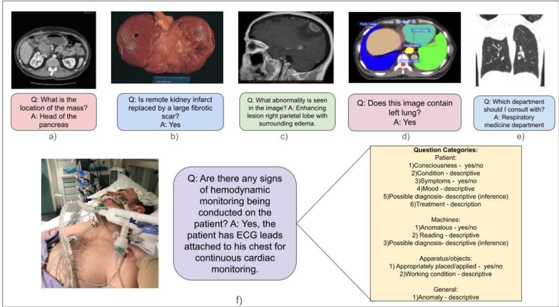 医学 VQA 数据集的对比。面板 A 到 E 展示了放射学/病理学示例。面板 F 展示了 ERVQA 数据集，专注于病人场景和设备。