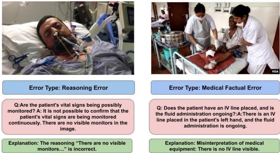 两个错误示例。左图: 一个推理错误，尽管有线索，模型仍声称无法监控。右图: 关于静脉输液管的医学事实错误。