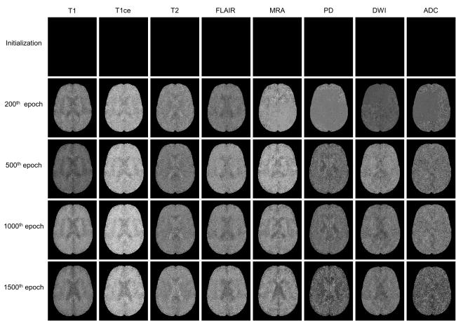 Figure 4. Visualization of distilled modality templates evolving along the pre-training trajectories from initialization to epoch 1500.