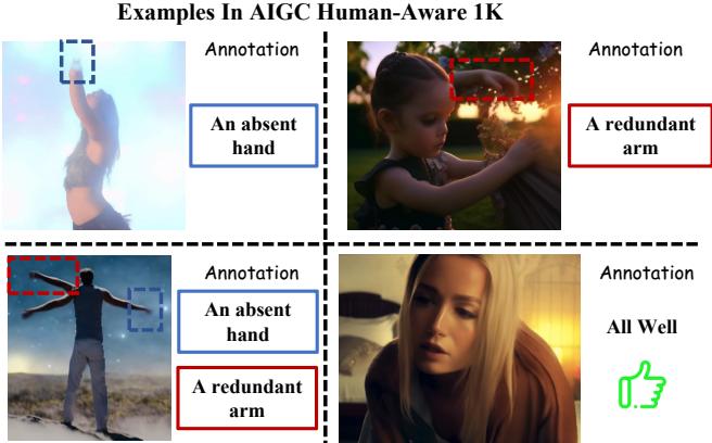 Figure 3 shows examples from the AIGC Human-Aware 1K dataset. It highlights the subtle and gross errors AI makes, from missing hands to extra arms fused at the shoulder.
