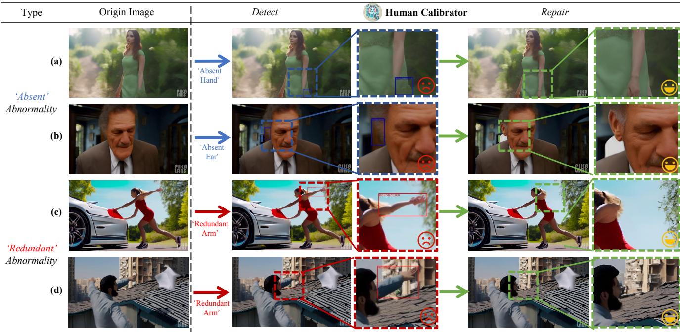 Figure 7 shows qualitative results. In (a) an absent hand is regenerated. In (c) a redundant arm is erased. The style remains consistent.