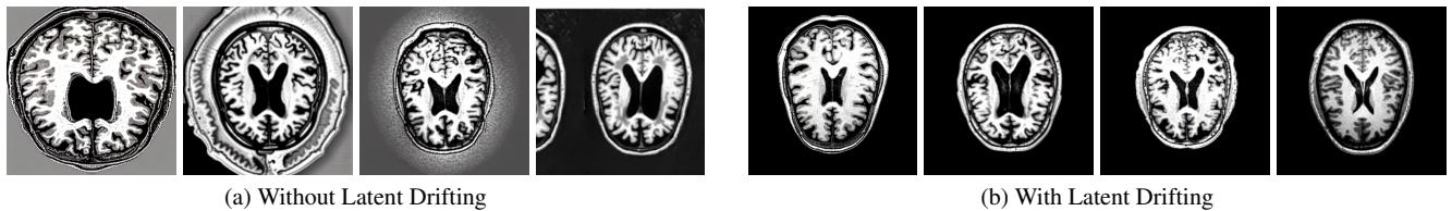 Visual comparison of MRI slice generation using different fine-tuning methods.
