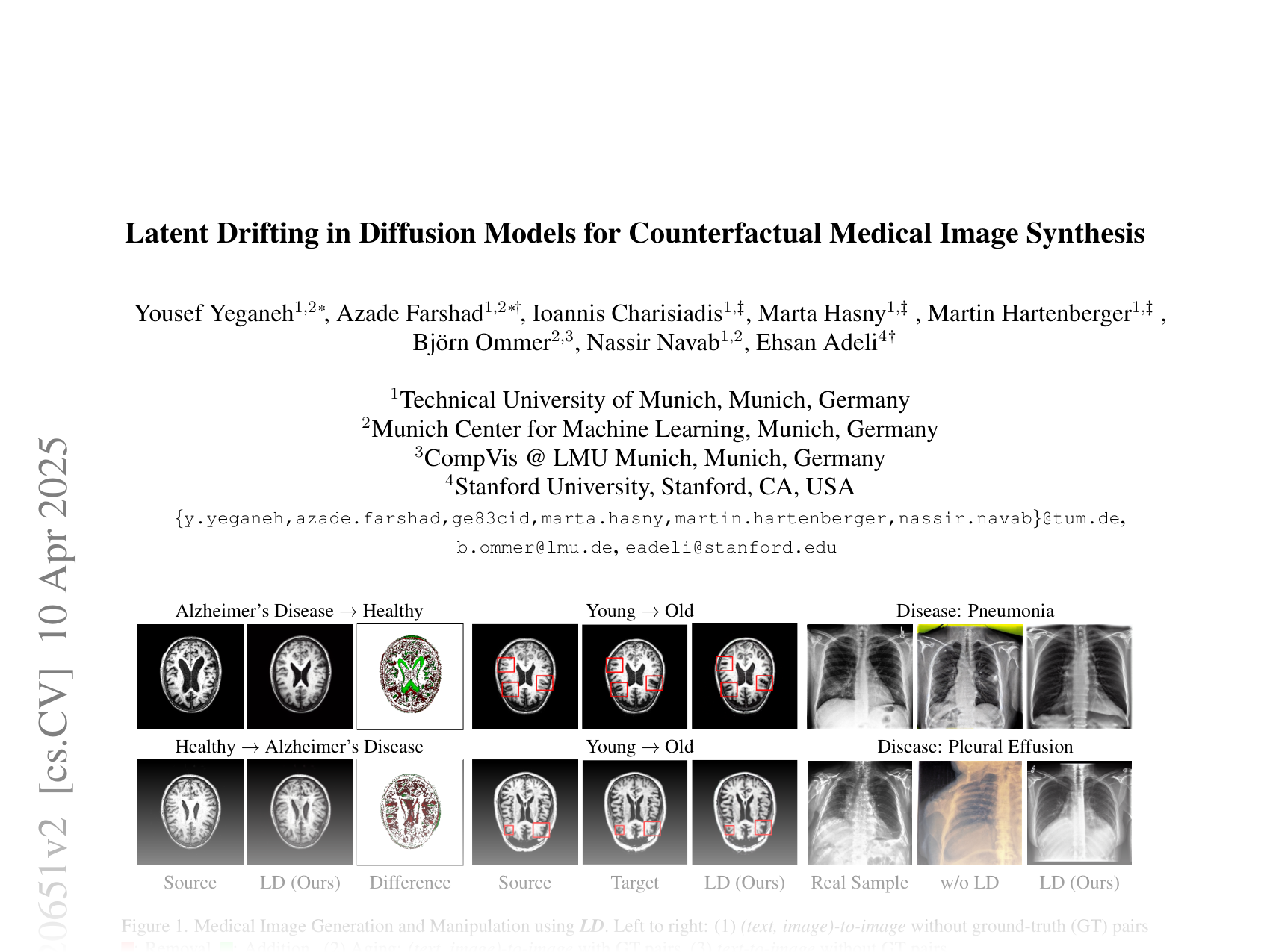 [Latent Drifting in Diffusion Models for Counterfactual Medical Image Synthesis 🔗](https://arxiv.org/abs/2412.20651)