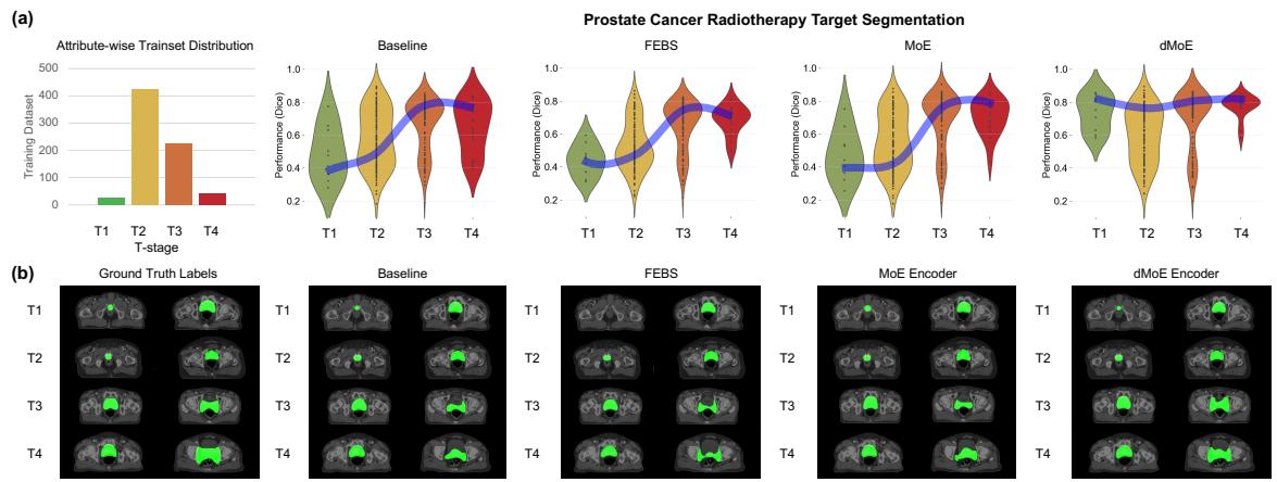 Figure 3: Violin plots and qualitative segmentation results. (a) Violin plots show dMoE maintains high performance across T-stages T1-T4 compared to Baseline and FEBS which drop at T1/T4. (b) Segmentation images show dMoE (far right) closely matching Ground Truth.