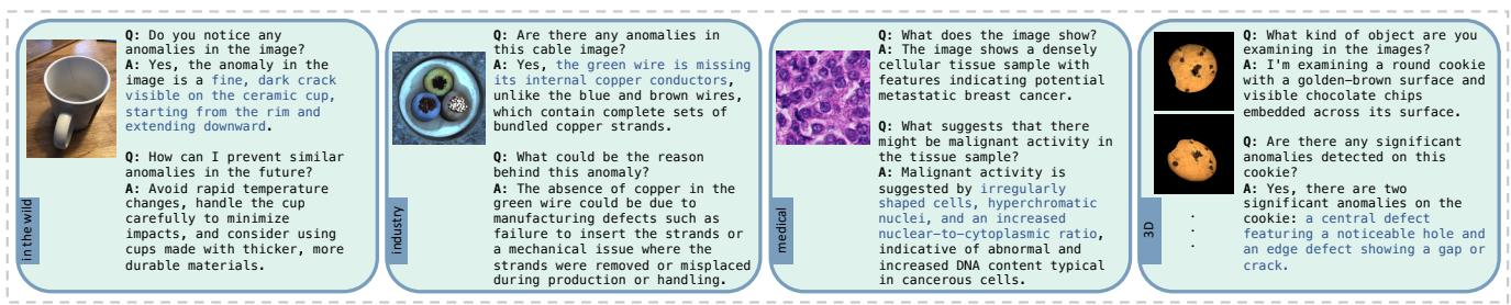 Figure 5. Composition of the instruction data in Anomaly-Instruct-125k.