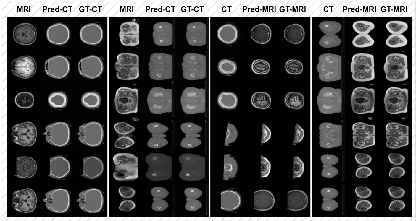 Figure 11: Case of modality transfer.
