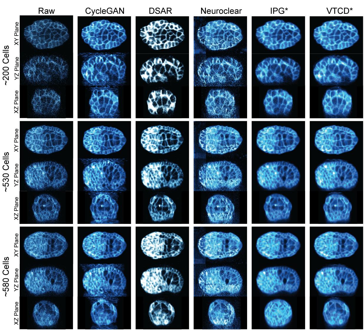 Fig. S1. The qualitative comparisons on fluorescence images between multiple methods (de-noising and super-resolution)
