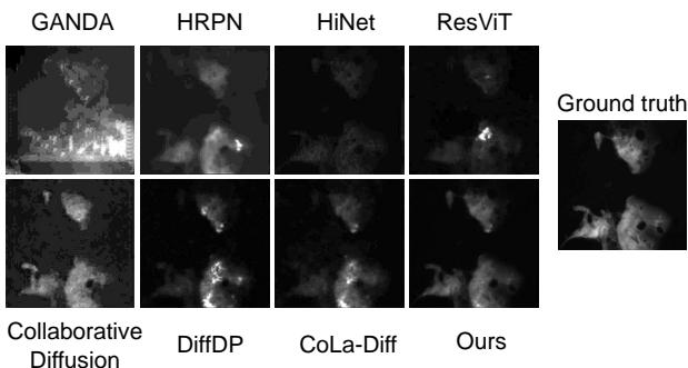 Figure 5. Qualitative comparison between the proposed method and other state-of-the-art methods at patch-level.
