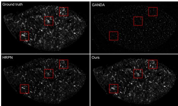 Figure 4. Qualitative comparison between the proposed method and the previous methods for NPs distribution at whole-slide level.