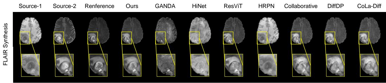 Figure 8. Visualization results of benchmark methods and DAMM-Diffusion on the BRATS dataset for the representative many-to-one synthesis task.