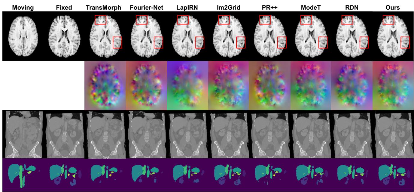 Figure 4 visual comparisons on Brain LPBA and Abdomen CT. The proposed method (last column) shows better alignment and fewer artifacts compared to others.