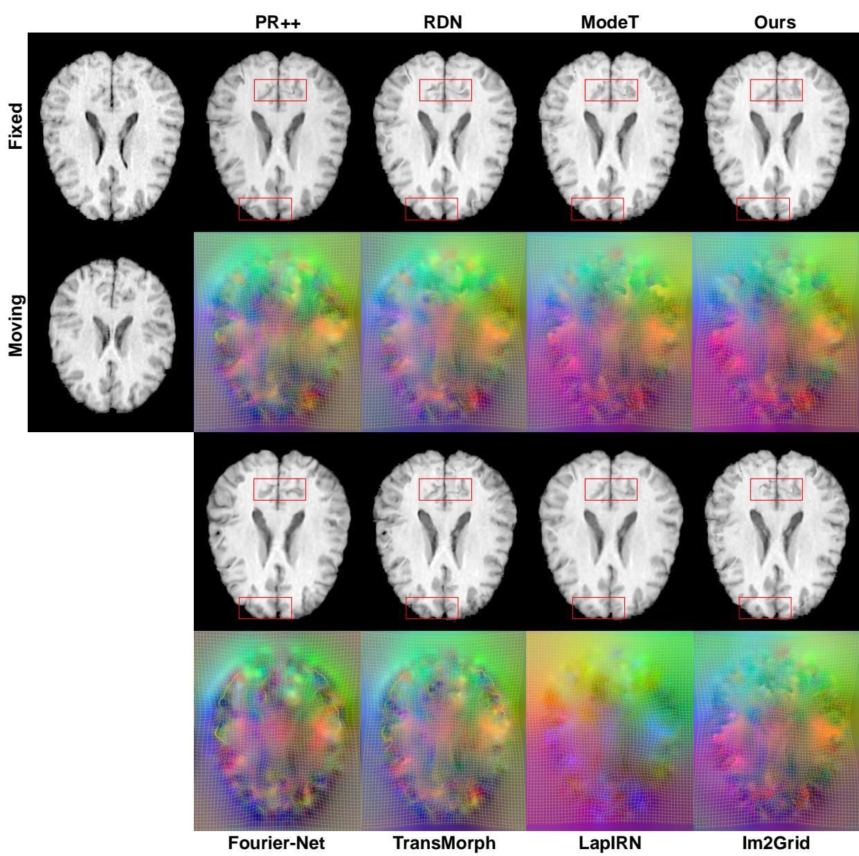 Figure 8: Visual comparisons on LPBA dataset showing warped images and displacement fields.