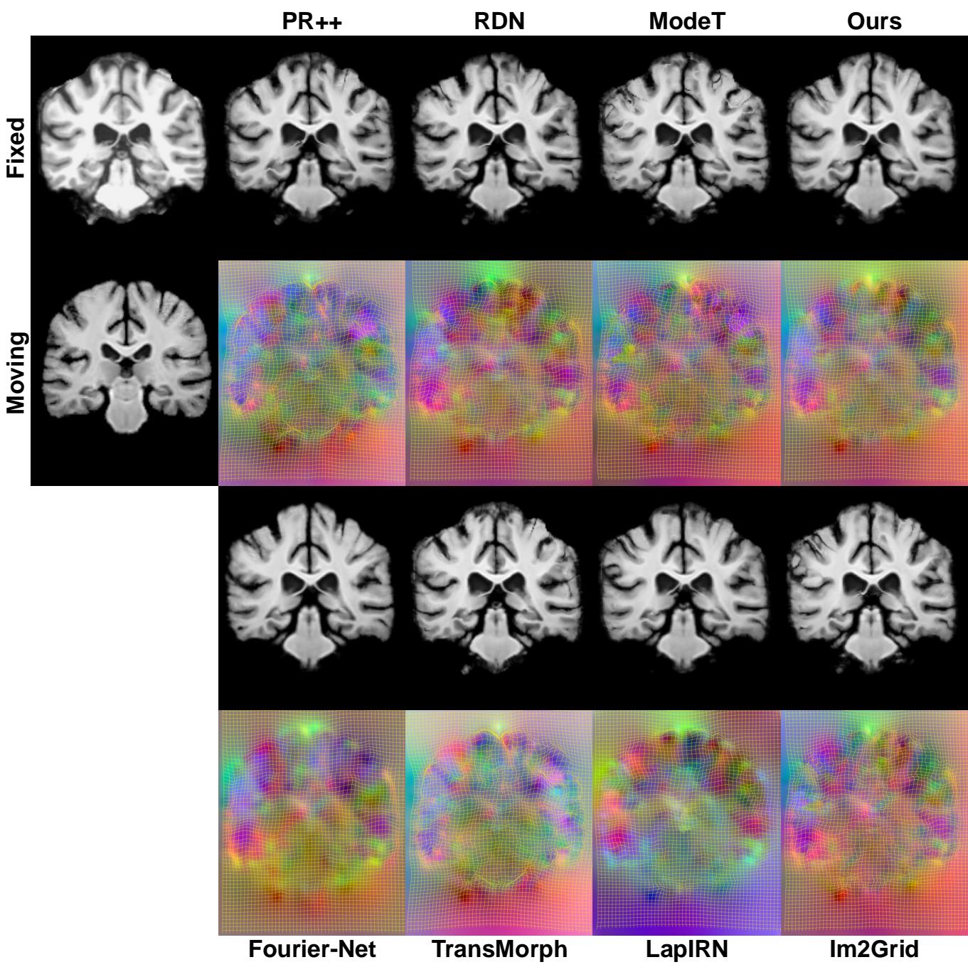 Figure 9: Visual comparisons on IXI dataset showing warped images and displacement fields.