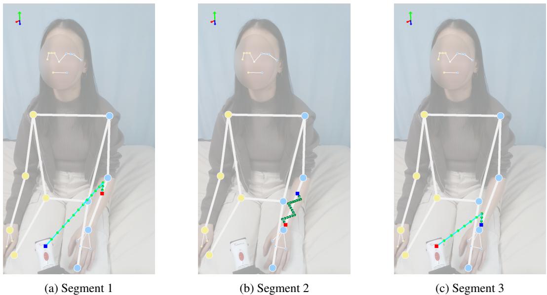 Figure 8: Example overlay visualization of trajectory 2 in the shaving task, for participant 2.
