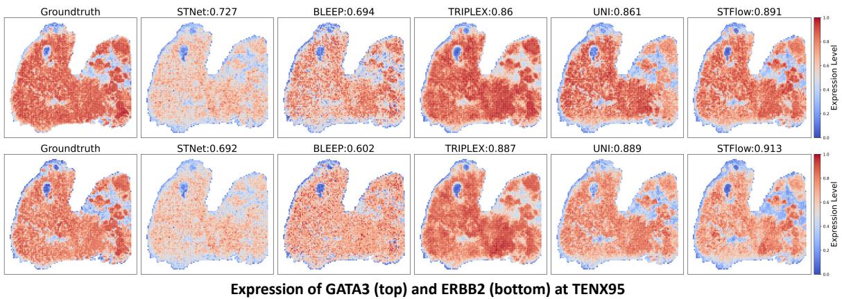 Figure 7. STFlow for Biomarker Discovery in Breast Samples (IDC dataset from HEST-1K).