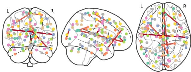 Figure 6: Brain network comparison.