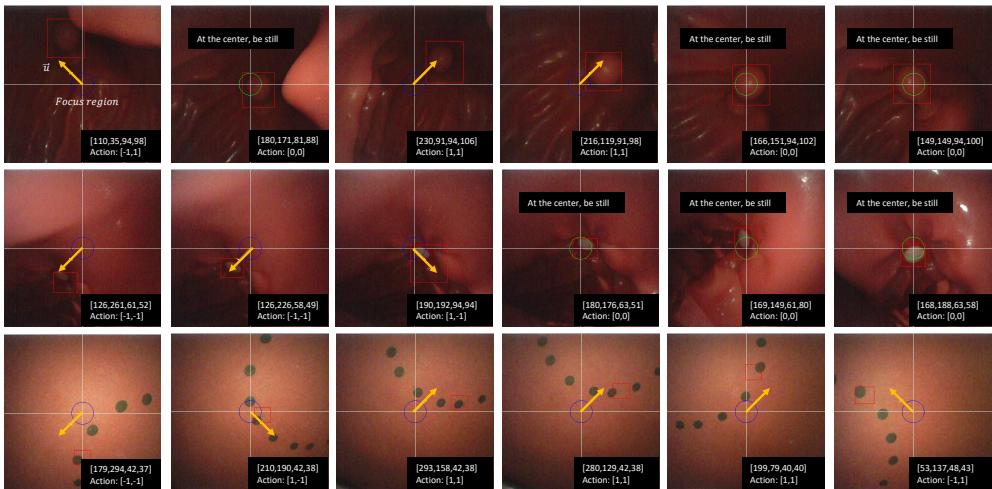 Figure 3: Example of successful rollouts on the real-world endoscopic tasks